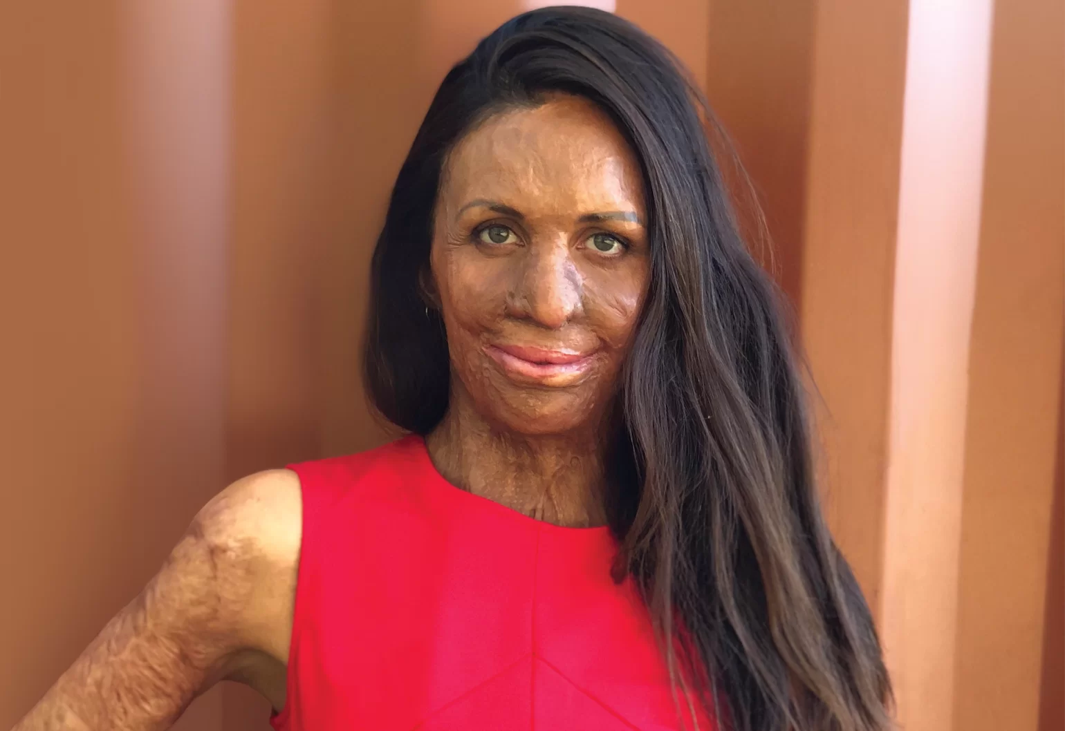 Turia Pitt on the engineering mindset that helped her get through tough