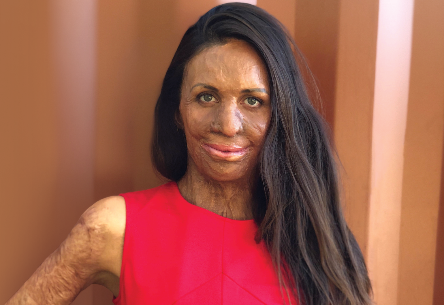 Turia pitt wedding