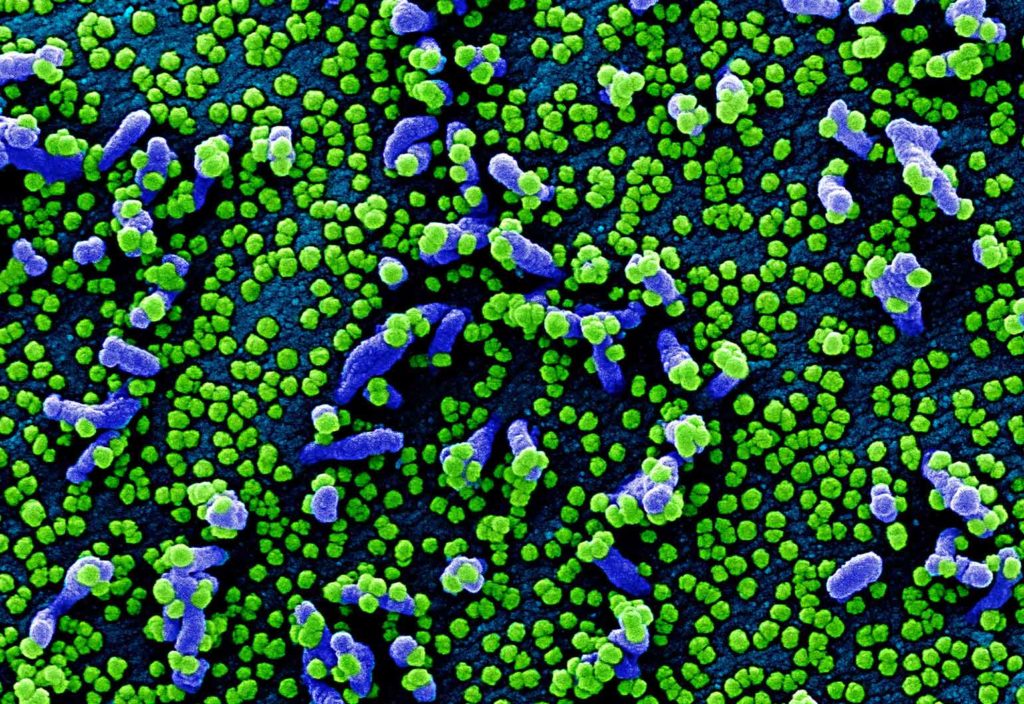 A colorised scanning electron micrograph of a VERO E6 cell (blue) heavily infected with SARS-COV-2 virus particles (green), isolated from a patient sample. Credit: NIAID