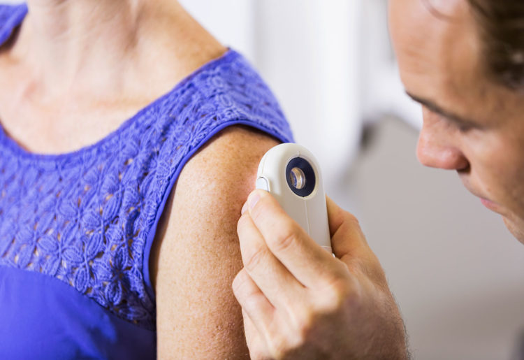 For the first time, researchers put AI skin cancer diagnosis to the test in the real world