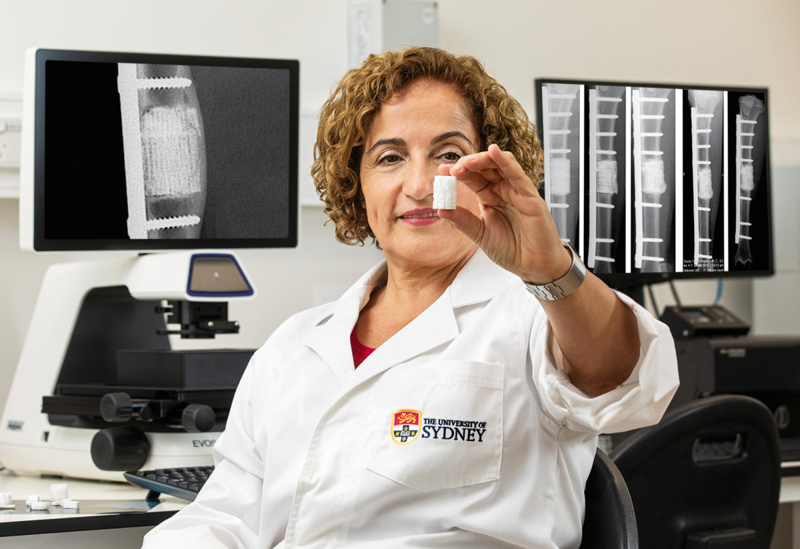 Hala Zreiqat wants to 3D print new bones on demand