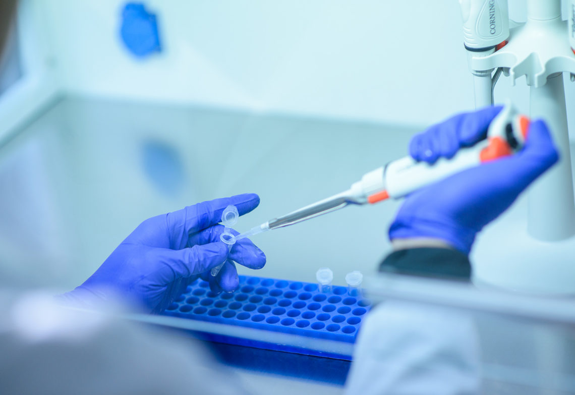 Australian engineers have developed a rapid COVID-19 antibody test
