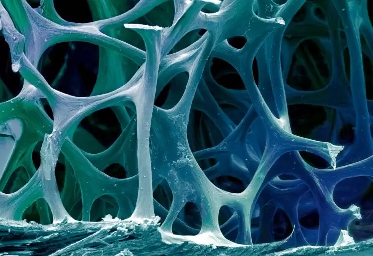 The bone-on-a-chip could be used to test new medical treatments for diseased or damaged bones.