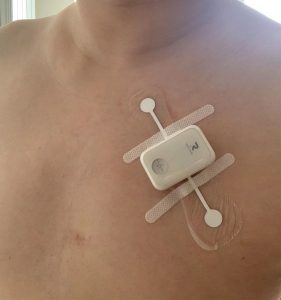 The prototype ECG patch to help detect heart attacks can be worn continuously for up to seven days.