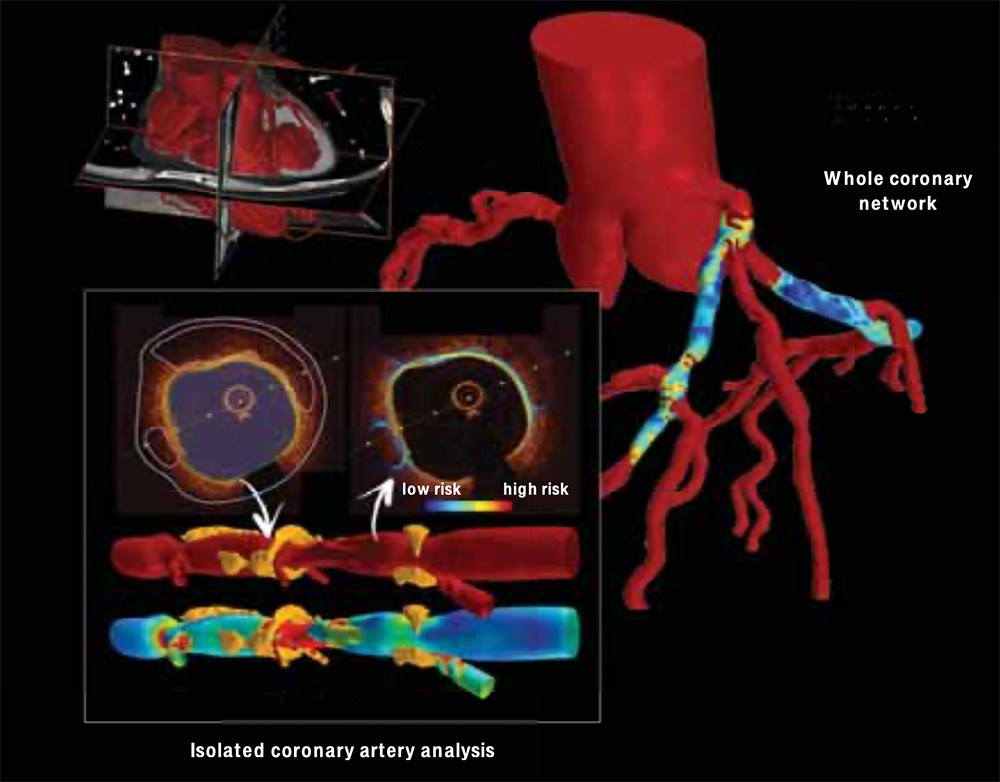 The detailed images produced by Navier Medical’s software.