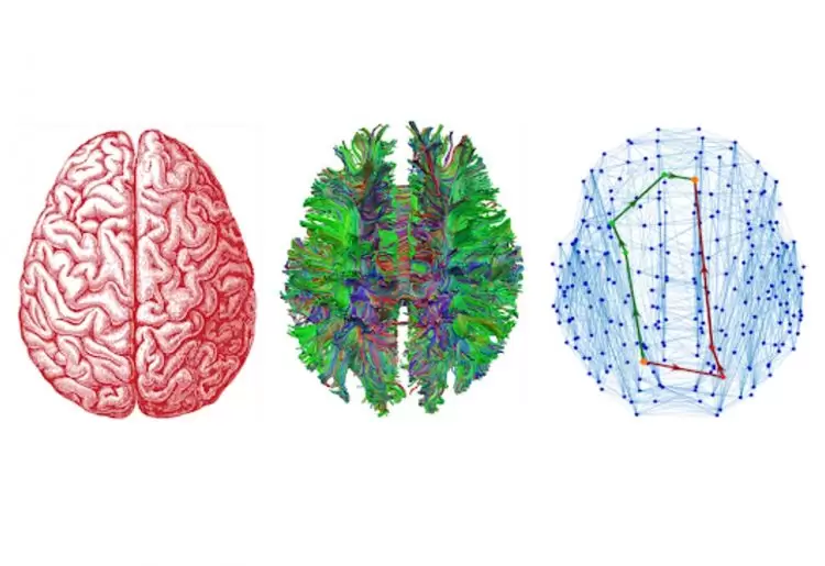 How electrical engineers designed groundbreaking treatment for depression