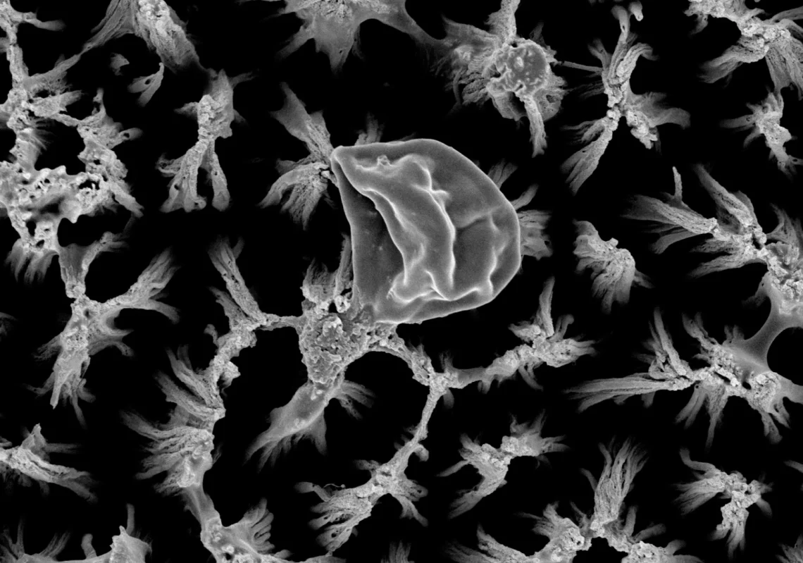 These tiny spikes skewer bacteria and fungi